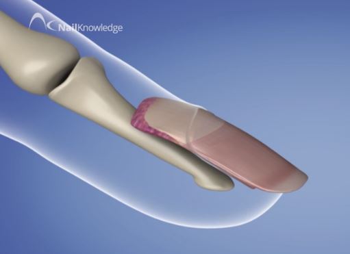 Đơn vị làm móng