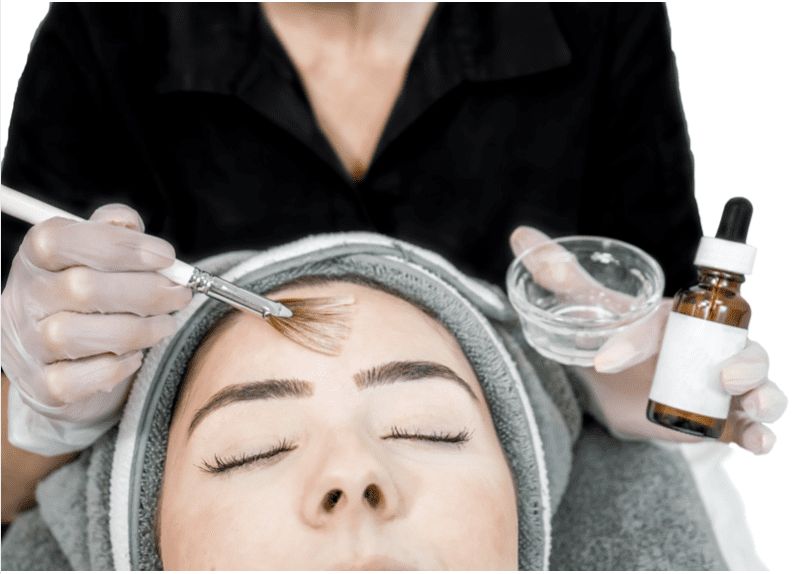 lột da bằng hóa chất