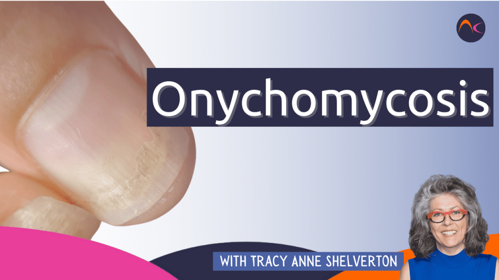 Onychomycosis (nail infections)