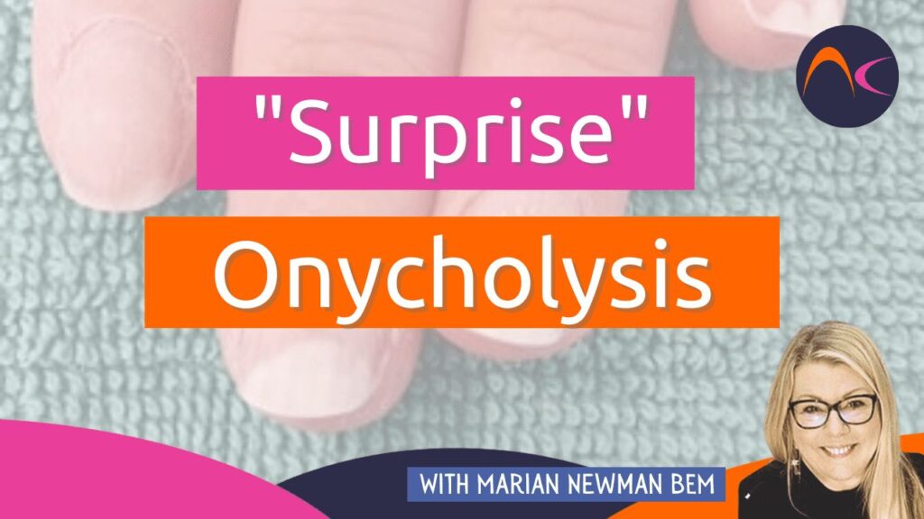 “Surprise” Onycholysis