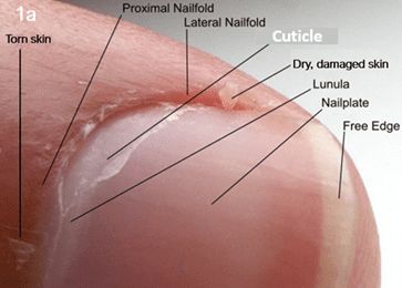 Cuticle on nail plate