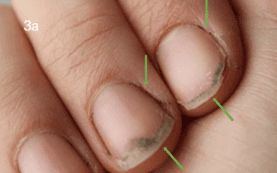 Dirty nails can cause product lifting