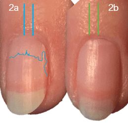 Light reflecting on nail comparison - with and without cuticle