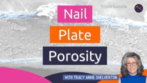 postagem no blog sobre a porosidade da placa ungueal