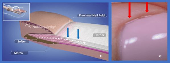 Nail Growth and product lifting