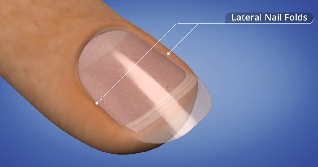 Paredes laterales de clavos