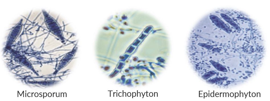 dermatofito