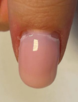 nail product lifting can be replaced without problem