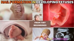 Fetal nail development