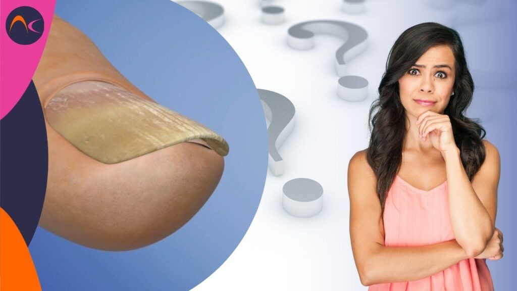 Nail Conditions Quizzes