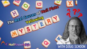 Finger Nail Plate Yellowing