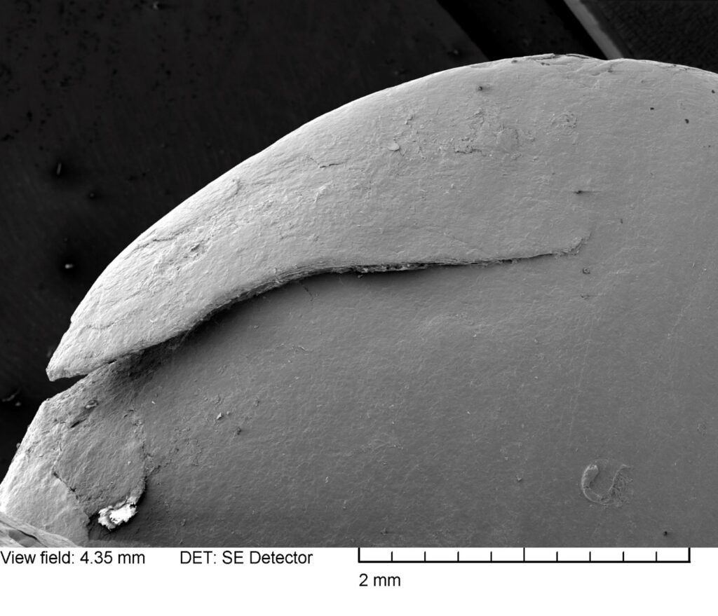 Brittle nails easily break, crack or shatter without much bending