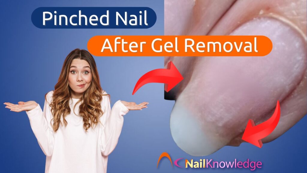 Pinched Nail After Gel Removal?